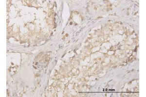 Immunoperoxidase of monoclonal antibody to CTSD on formalin-fixed paraffin-embedded human testis. (Cathepsin D Antikörper  (AA 26-412))