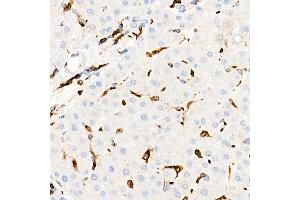 Immunohistochemistry of paraffin-embedded Human liver using CD74 antibody (ABIN7267759) at dilution of 1:100 (40x lens). (CD74 Antikörper)