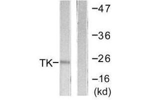 Western blot analysis of extracts from COLO205 cells, using TK (Ab-13) antibody.