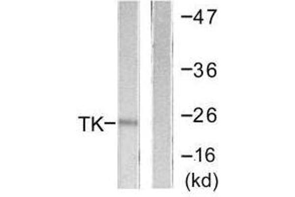 TK1 anticorps  (Ser13)
