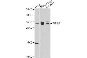 Western blot analysis of extracts of various cell lines, using TIRAP antibody. (TIRAP Antikörper  (AA 1-221))