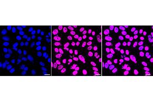 anti-Jun B Proto-Oncogene (JUNB) antibody