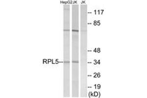 Western blot analysis of extracts from Jurkat/HepG2 cells, using RPL5 Antibody. (RPL5 Antikörper  (AA 161-210))
