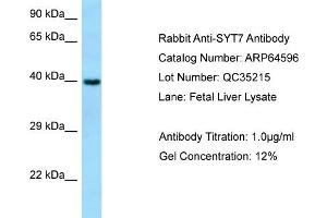 Western Blotting (WB) image for anti-Synaptotagmin VII (SYT7) (N-Term) antibody (ABIN971838) (SYT7 Antikörper  (N-Term))