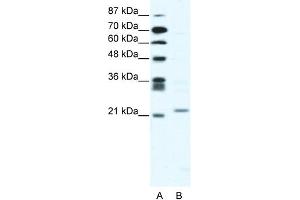 WB Suggested Anti-TWIST1 Antibody Titration:  2.