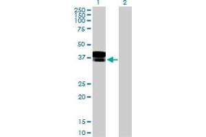 Western Blot analysis of DCN expression in transfected 293T cell line by DCN MaxPab polyclonal antibody. (Decorin Antikörper  (AA 1-359))
