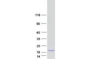Western Blotting (WB) image for Vesicle-Associated Membrane Protein 5 (Myobrevin) (VAMP5) protein (Myc-DYKDDDDK Tag) (ABIN2735165)