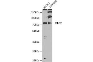 Western blot analysis of extracts of various cell lines, using IFFO2 antibody (ABIN6133429, ABIN6142160, ABIN6142161 and ABIN6223442) at 1:1000 dilution. (IFFO2 Antikörper)