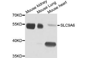 Western blot analysis of extract of various cells, using SLC9A6 antibody. (SLC9A6 Antikörper)