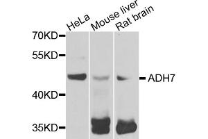 Western blot analysis of extracts of various cell lines, using ADH7 antibody. (ADH7 Antikörper)