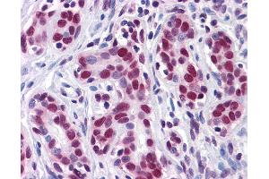 Anti-HuR antibody IHC of human breast. (ELAVL1 Antikörper  (AA 1-101))