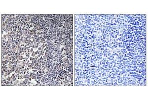 Immunohistochemistry analysis of paraffin-embedded human tonsil tissue using MRPS16 antibody. (MRPS16 Antikörper  (Internal Region))