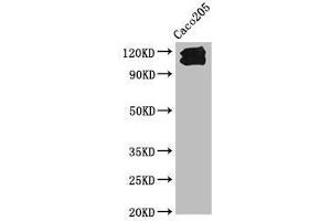 Western Blot Positive WB detected in: Caco205 whole cell lysate All lanes: CDH1 antibody at 1:1000 Secondary Goat polyclonal to Mouse IgG at 1/10000 dilution Predicted band size: 98, 91 kDa Observed band size: 110, 120 kDa (E-cadherin Antikörper  (AA 155-707))