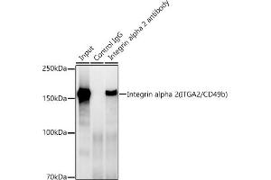 Immunoprecipitation (IP) image for anti-Integrin alpha 2 (ITGA2) antibody (ABIN7267918)
