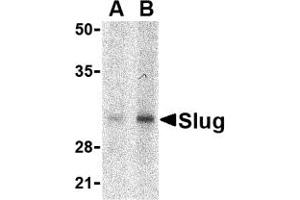 Western Blotting (WB) image for anti-SLUG (Middle Region 1) antibody (ABIN1031191) (SLUG Antikörper  (Middle Region 1))