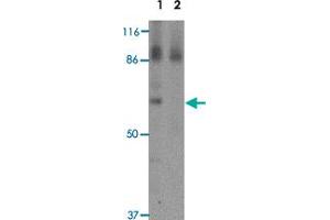 Western blot analysis of RBM35A in rat colon tissue lysate with RBM35A polyclonal antibody  at 0. (ESRP1 Antikörper  (N-Term))