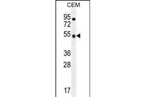 TBC1D13 Antibody (Center) (ABIN655819 and ABIN2845243) western blot analysis in CEM cell line lysates (35 μg/lane). (TBC1D13 Antikörper  (AA 76-105))