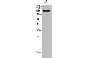 Western Blot analysis of 293 cells using KIF20A Polyclonal Antibody (KIF2A Antikörper)