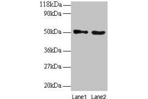 Western blot All lanes: VOPP1 antibody at 2 μg/mL Lane 1: EC109 whole cell lysate Lane 2: 293T whole cell lysate Secondary Goat polyclonal to rabbit IgG at 1/15000 dilution Predicted band size: 20, 19, 18 kDa Observed band size: 50 kDa (VOPP1 Antikörper  (AA 23-172))