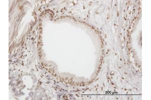 Immunoperoxidase of monoclonal antibody to IFI16 on formalin-fixed paraffin-embedded human prostate. (IFI16 Antikörper  (AA 630-729))