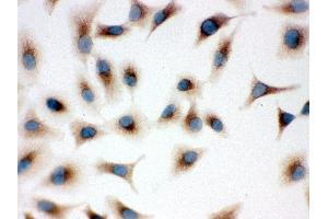 Immunohistochemistry (IHC) image for anti-Toll-Like Receptor 7 (TLR7) (AA 1020-1047), (C-Term) antibody (ABIN3043948)