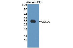 Western blot analysis of the recombinant protein. (VEGFB Antikörper  (AA 21-207))