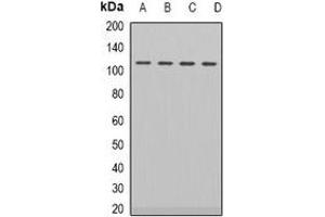 Western blot analysis of Androgen Receptor expression in HEK293T (A), LOVO (B), NIH3T3 (C), PC12 (D) whole cell lysates. (Androgen Receptor Antikörper)