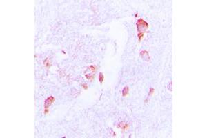 Immunohistochemical analysis of CSRNP2 staining in human brain formalin fixed paraffin embedded tissue section.
