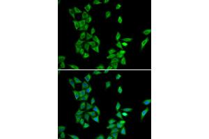 Immunofluorescence analysis of HeLa cells using ANXA4 antibody (ABIN6290015). (Annexin IV Antikörper)
