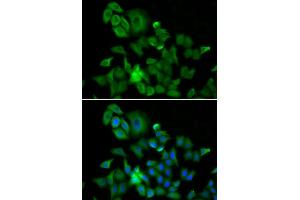 Immunofluorescence analysis of A549 cell using HMMR antibody. (HMMR Antikörper  (AA 341-440))
