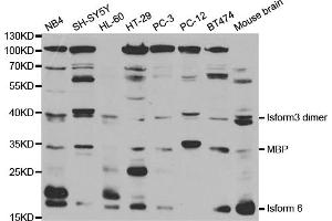 Western blot analysis of extracts of various cell lines, using MBP antibody. (MBP Antikörper)