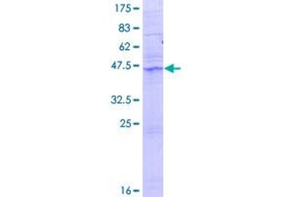 ACER2 Protein (AA 1-226) (GST tag)