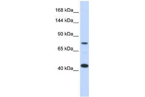 WB Suggested Anti-LRP8 Antibody Titration:  0.