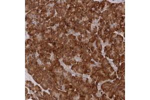 Immunohistochemical staining of human pancreas with ARHGEF10L polyclonal antibody  shows strong cytoplasmic positivity in exocrine cells at 1:10-1:20 dilution.