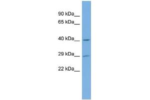 WB Suggested Anti-NAT15 Antibody Titration:  0. (NAT15 Antikörper  (Middle Region))