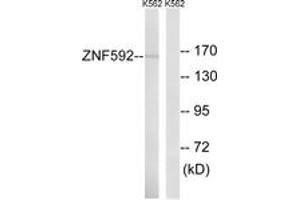 Western blot analysis of extracts from K562 cells, using ZNF592 Antibody. (ZNF592 Antikörper  (AA 961-1010))