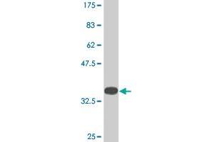 Western Blot detection against Immunogen (35. (KDM5B Antikörper  (AA 231-319))