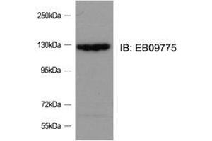Western Blotting (WB) image for anti-SLIT-ROBO rho GTPase Activating Protein 2 (SRGAP2) (Internal Region) antibody (ABIN2464859) (SRGAP2 Antikörper  (Internal Region))