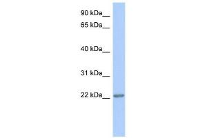 TRAPPC5 antibody used at 1 ug/ml to detect target protein. (TRAPPC5 Antikörper  (Middle Region))