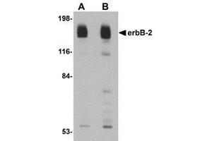 Western blot analysis of erbB-2 in rat liver tissue lysate with AP30319PU-N erbB-2 antibody at (A) 1 and (B) 2 μg/ml.