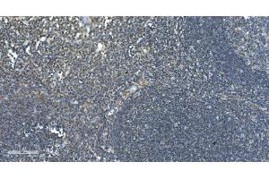 IHC analysis of LSM7 using anti-LSM7 antibody (ABIN7598937).