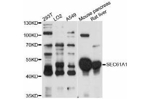 Western blot analysis of extracts of various cell lines, using SEC61A1 antibody (ABIN5998770) at 1:3000 dilution. (SEC61A1 Antikörper)