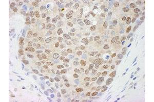 anti-Cullin 4A (CUL4A) (C-Term) antibody