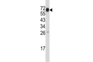 Western Blotting (WB) image for anti-Endoglin (ENG) (AA 380-409) antibody (ABIN3030354)