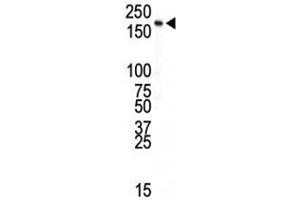 Western Blotting (WB) image for anti-Insulin Receptor (INSR) (AA 21-52) antibody (ABIN3031335)