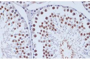 Immunohistochemistry of paraffin-embedded Rat testis using DNMT3L Polyclonal Antibody at dilution of 1:100 (40x lens). (DNMT3L Antikörper)