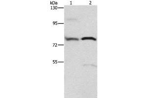 Western Blot analysis of 293T cell and Human fetal brain tissue using ATXN1 Polyclonal Antibody at dilution of 1:800 (Ataxin 1 Antikörper)