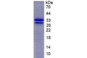 SDS-PAGE (SDS) image for Superoxide Dismutase 3, Extracellular (SOD3) (AA 25-251) protein (His tag) (ABIN1080871)
