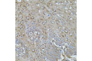 Immunohistochemistry (Paraffin-embedded Sections) (IHC (p)) image for anti-Filamin B, beta (FLNB) (AA 1686-1785) antibody (ABIN1679857)