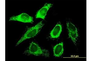 Immunofluorescence of purified MaxPab antibody to SLC25A3 on HeLa cell. (SLC25A3 Antikörper  (AA 1-361))